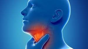 RECURRENT THROAT INFECTION