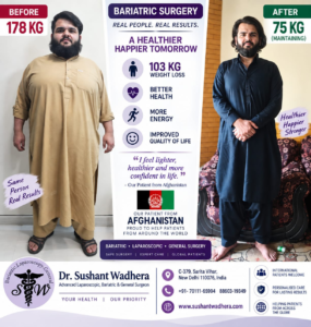 International Patients